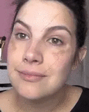 Whitening Cream for Women Fade Melasma