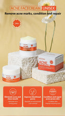 Oil Control Acne Cream for Clear Skin