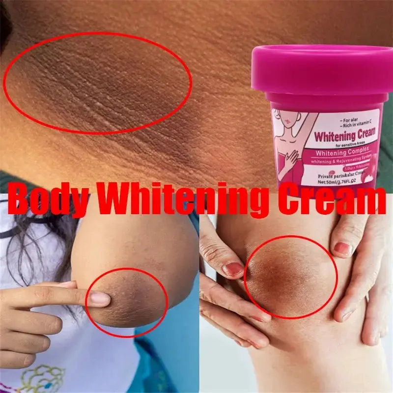 Body Whitening Bleach Cream Brighten Underarm Elbow Knees Joint Removal Intimate Parts Dark Spots Melanin Snow Bleach Cream