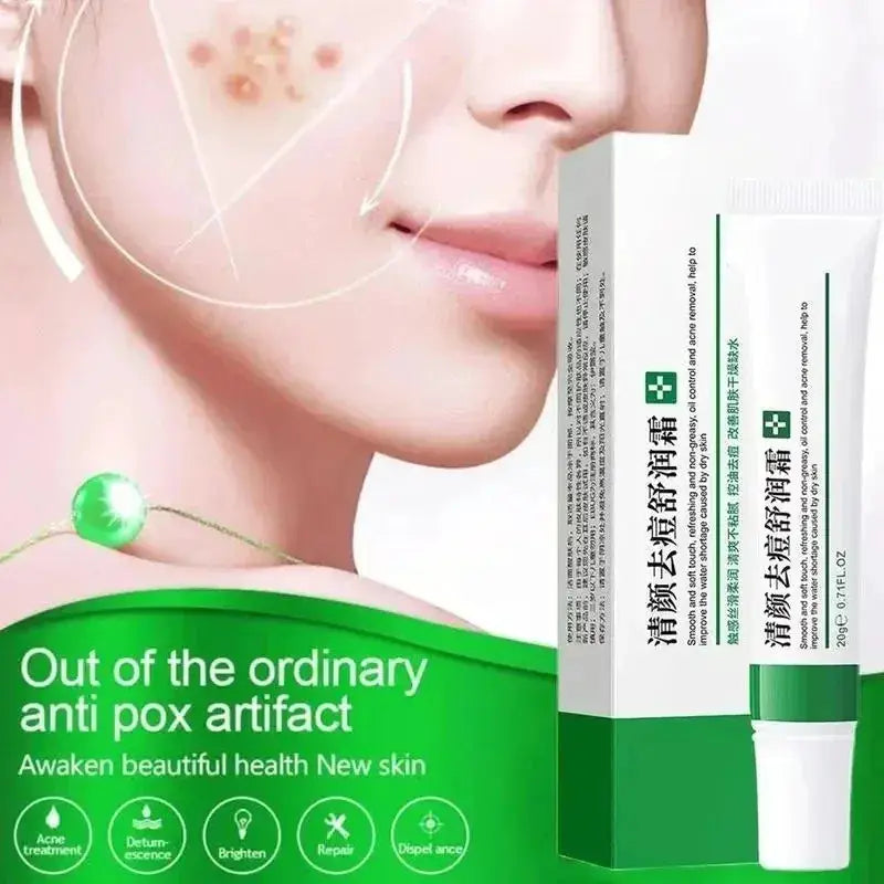 20g Whitening Freckle Cream Remove Dark Spot Cream Anti Freckle and Aging Cream Fade Pigmentation Melasma Brighten Serum Skin