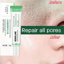 Pore Tightening Cream for Large Pores