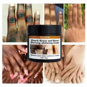Dark Knuckles Brightening Cream For Elbows And Knees Body Whitening Serum