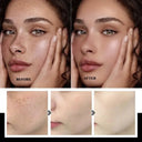 Brightening Niacinamide Cream for All