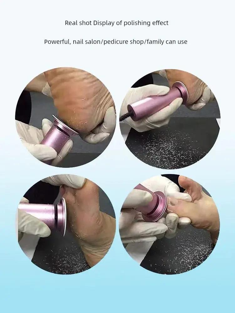 Electric Foot Grinder for Dead Skin and Calluses Removal