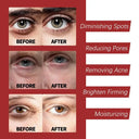 Smart Retinol Face Cream For Wrinkles Instant Lift Night