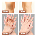 Dark Knuckles Brightening Cream For Elbows And Knees Body Whitening Serum