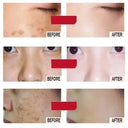 Whitening Cream for Women Fade Melasma