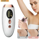 IPL Hair Removal Device For Home