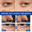 Firming Eye Roll On For Puffiness Now