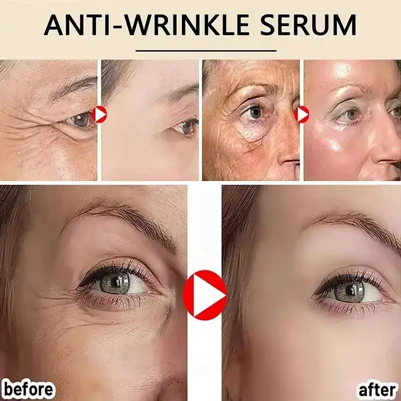 Retinol Anti-wrinkle Cream Collagen Anti-Aging Instant Removal Face Neck Wrinkle Efficient Moisturizing Firming Korean Skin Care