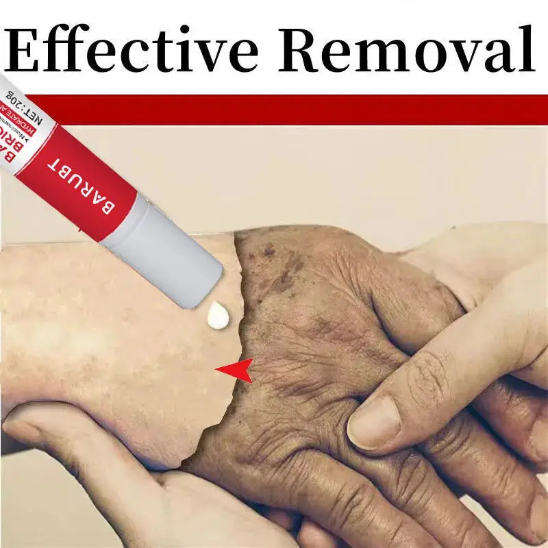Powerful Spot-removing Whitening Cream Brighten Skin Fast Eliminates Melanin Pigmentation Melasma Dark Spots Korean Skin Care