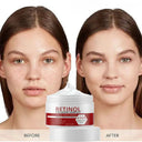 Facial Whitening Cream for Dark Spots