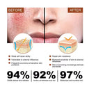 Facial Redness Repair Cream For Sensitive Skin Rosacea Hydrating Day Night
