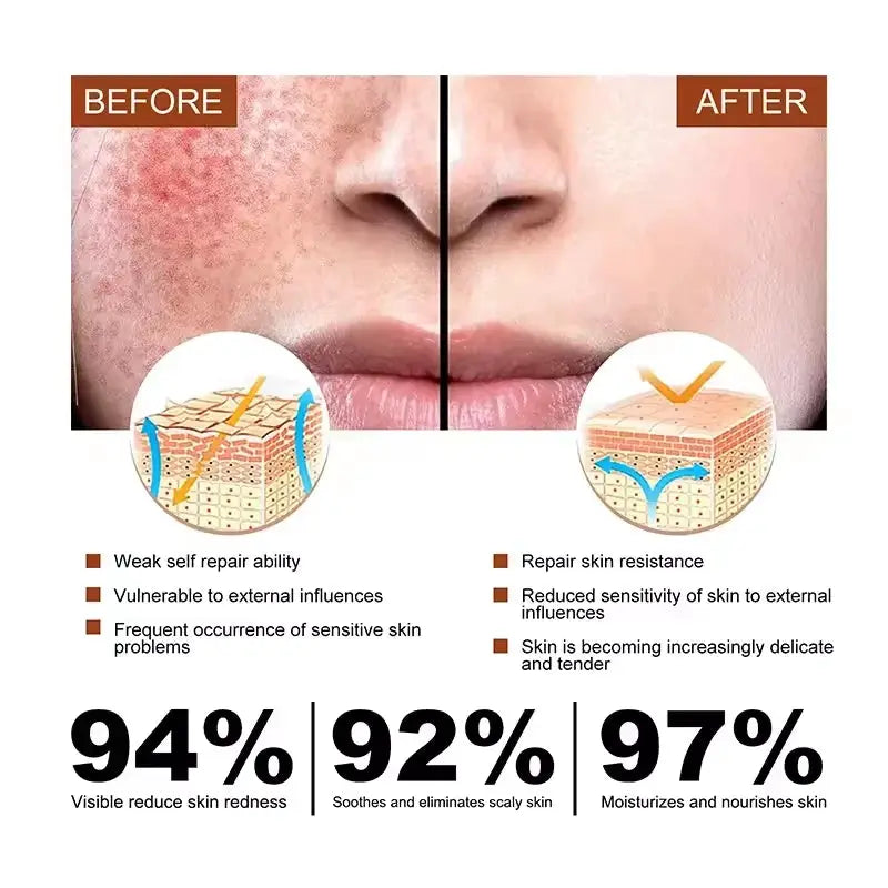 Facial Redness Repair Cream Improve Sensitive Skin Dryness Hydrating Sooth Lotion Removal Rosacea Day Night Korean Cosmetics