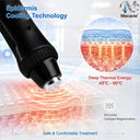 Soprano Titanium Laser Hair Removal