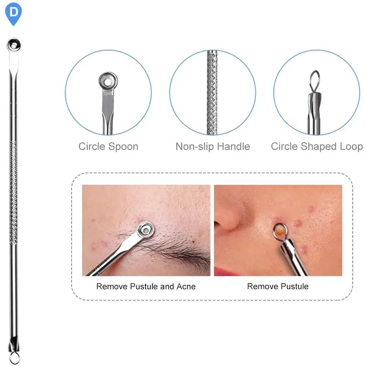 Acne Needle Blackhead Remover Set 4pcs Comedone Kit