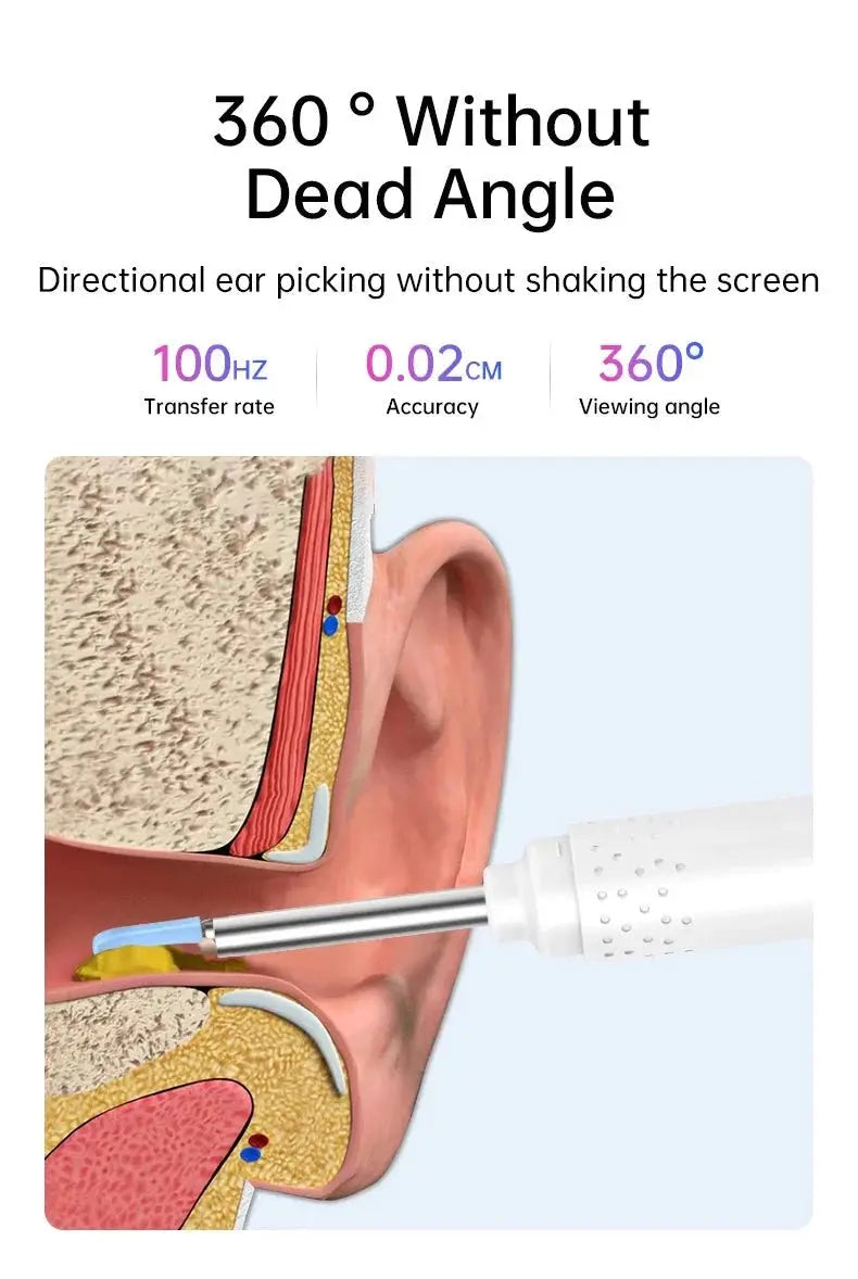 Ear Wax Endoscope for Safe Home Cleaning — product view 14