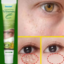 Eelhoe Fat Granules Remover Eye Cream Unisex Whitening 20ml