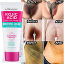 Intimate Whitening Cream for Private Parts Underarms Dark Melanin Removal