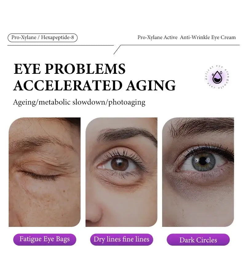 Instant Eye Bag Removal Cream Retinol Anti-Wrinkle Firming Skin Fade Fine Lines Anti Dark Circle Puffiness Brighten Eye skinCare