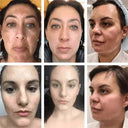 LAIKOU Whitening Spot Removing Cream For Dark Spots Melasma Brightening
