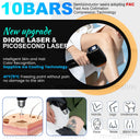 Myoslim Diode Laser Hair Removal