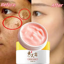 Freckle Cream For Brighter Skin