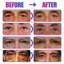 Brightening Retinol Eye Cream for Adults