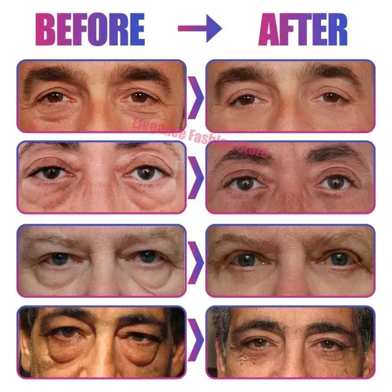 Instant Eye Bag Remove Eye Cream Anti Fat Particles Dark Circles Puffiness Fade Fine Lines Lift Brighten Korean Beauty Eye Care