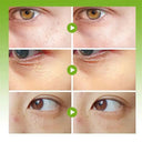 Eelhoe Fat Granules Remover Eye Cream Unisex Whitening 20ml