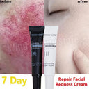 Facial Redness Repair Cream For Sensitive Skin Rosacea Hydrating Day Night