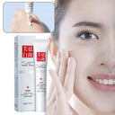 Hydrating Freckle Cream for All Skin