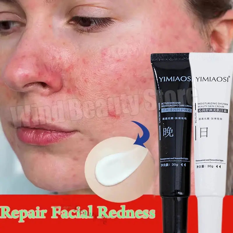 Facial Redness Repair Cream Improve Sensitive Skin Dryness Hydrating Sooth Lotion Removal Rosacea Day Night Korean Cosmetics