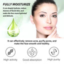 Hoygi Acne Cream for Oily Skin Relief