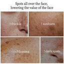 LAIKOU Whitening Spot Removing Cream For Dark Spots Melasma Brightening