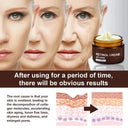 Smart Retinol Face Cream For Wrinkles Instant Lift Night