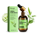 Hoygi Acne Cream for Oily Skin Relief