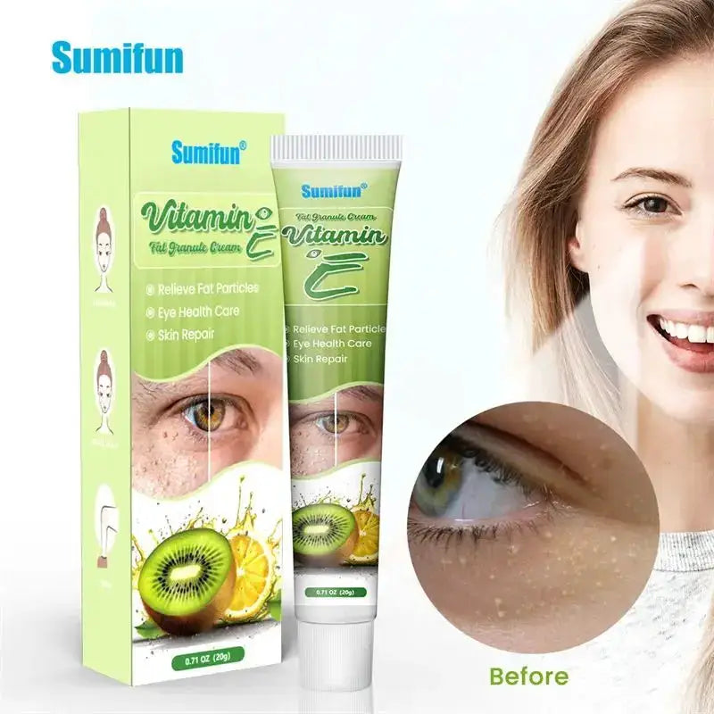 Fat Granules Remover Eye Cream Skin Care Products