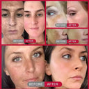 Face Cream for All Skin Brightens Tone
