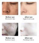 Whitening Cream for Women Fade Melasma