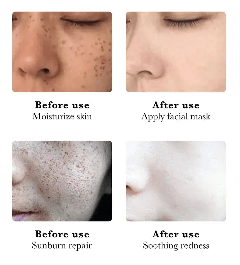 Whitening Cream for Women Fade Melasma — product view 17