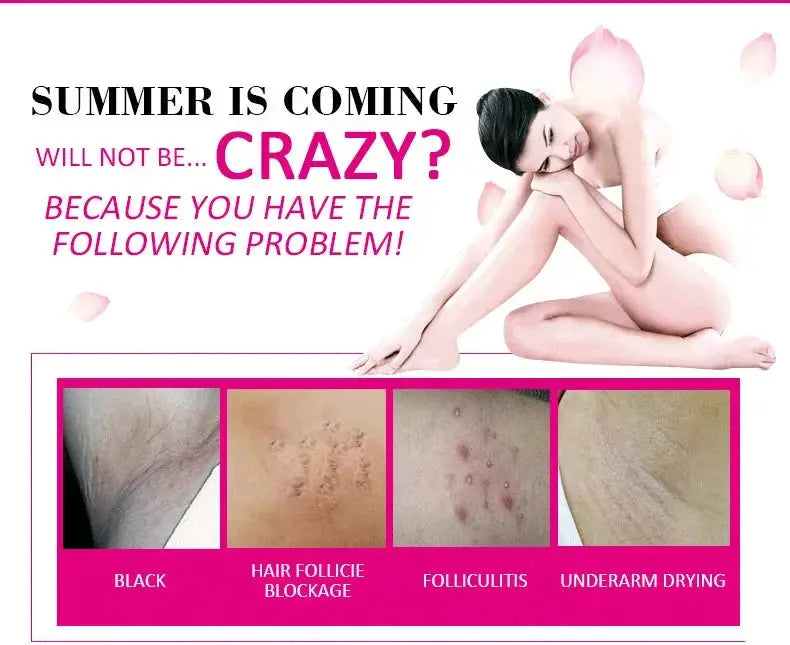 Body Whitening Bleach Cream Brighten Underarm Elbow Knees Joint Removal Intimate Parts Dark Spots Melanin Snow Bleach Cream