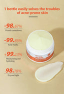 Oil Control Acne Cream for Clear Skin