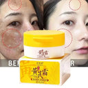 Whitening Freckle Face Cream for Melasma