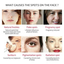 Freckle Cream for Women Night Repair