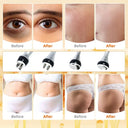 Moonic Cavitation Machine For Fat Loss
