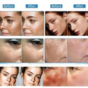 Powerful Korean Spot Removing Whitening Cream For Bright Skin And Dark Spots