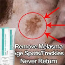 Spot Whitening Cream For Dark Spots