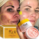 Freckle Cream For Brighter Skin