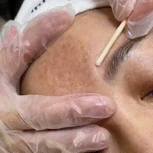 Powerful Spot-removing Whitening Cream Brighten Skin Fast Eliminates Melanin Pigmentation Melasma Dark Spots Korean Skin Care